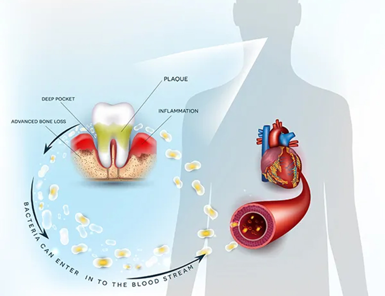 下松市（山口県）の歯医者、たけなわ歯科口腔外科クリニックのクリーニング