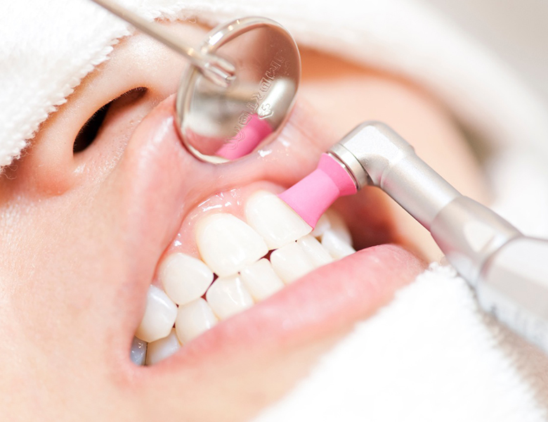 下松市（山口県）の歯医者、たけなわ歯科口腔外科クリニックのクリーニング